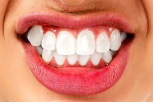 ¿Por qué rechinamos los dientes? Todo sobre el bruxismo
