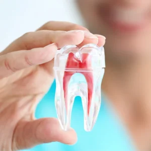 Salva tus Dientes con Tratamiento de Endodoncia 
