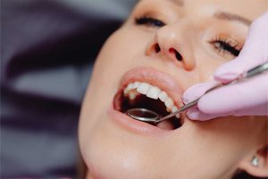 Recupera tu Sonrisa con Implantes Dentales 