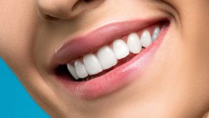Transforma tu Sonrisa con Estética Dental: Carillas, Blanqueamiento y Gingivectomía 