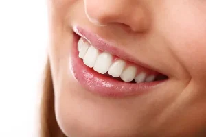 Blanqueamiento Dental: Expectativas vs. Realidad