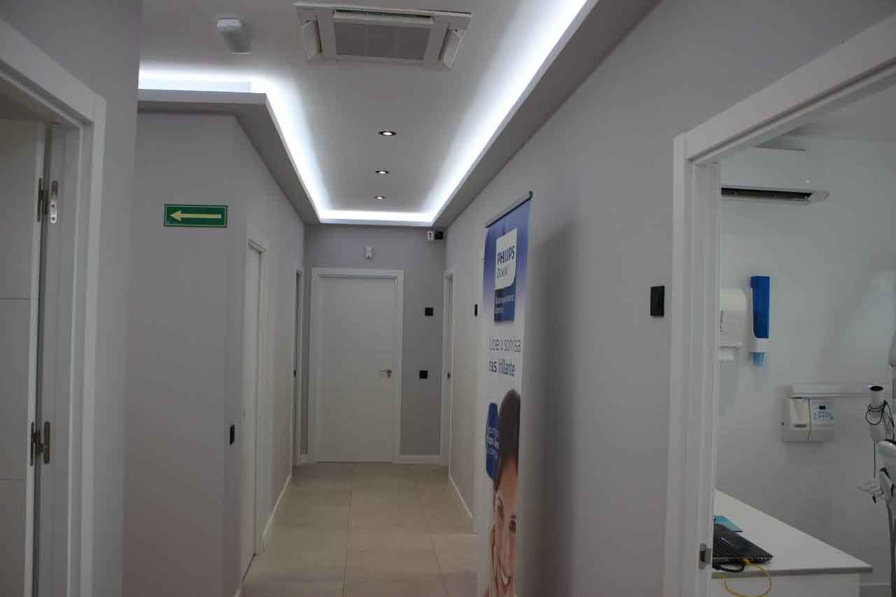 clinica dental en merida - carillas dentales